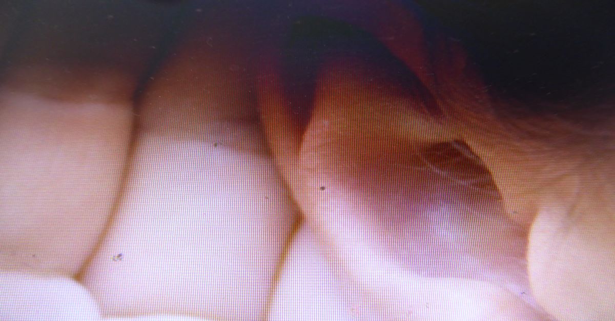 Image of an ear (listening)